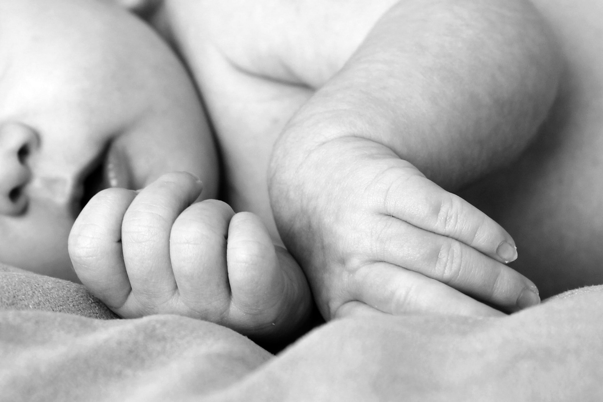 peau atopique bebe eczema